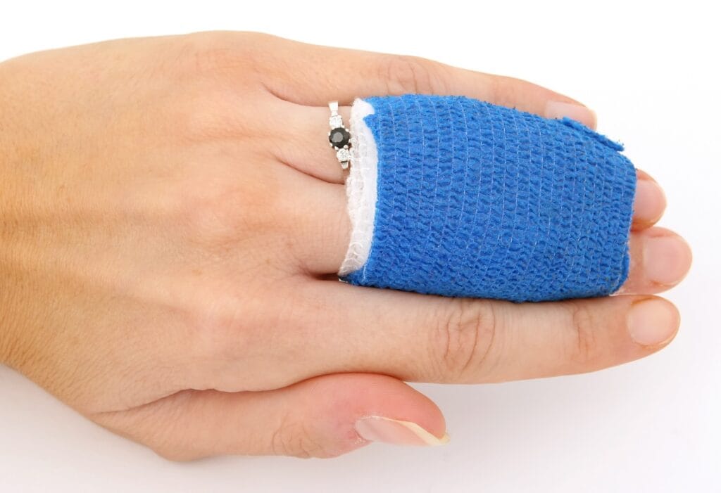 Hand with blue bandaged finger and ring